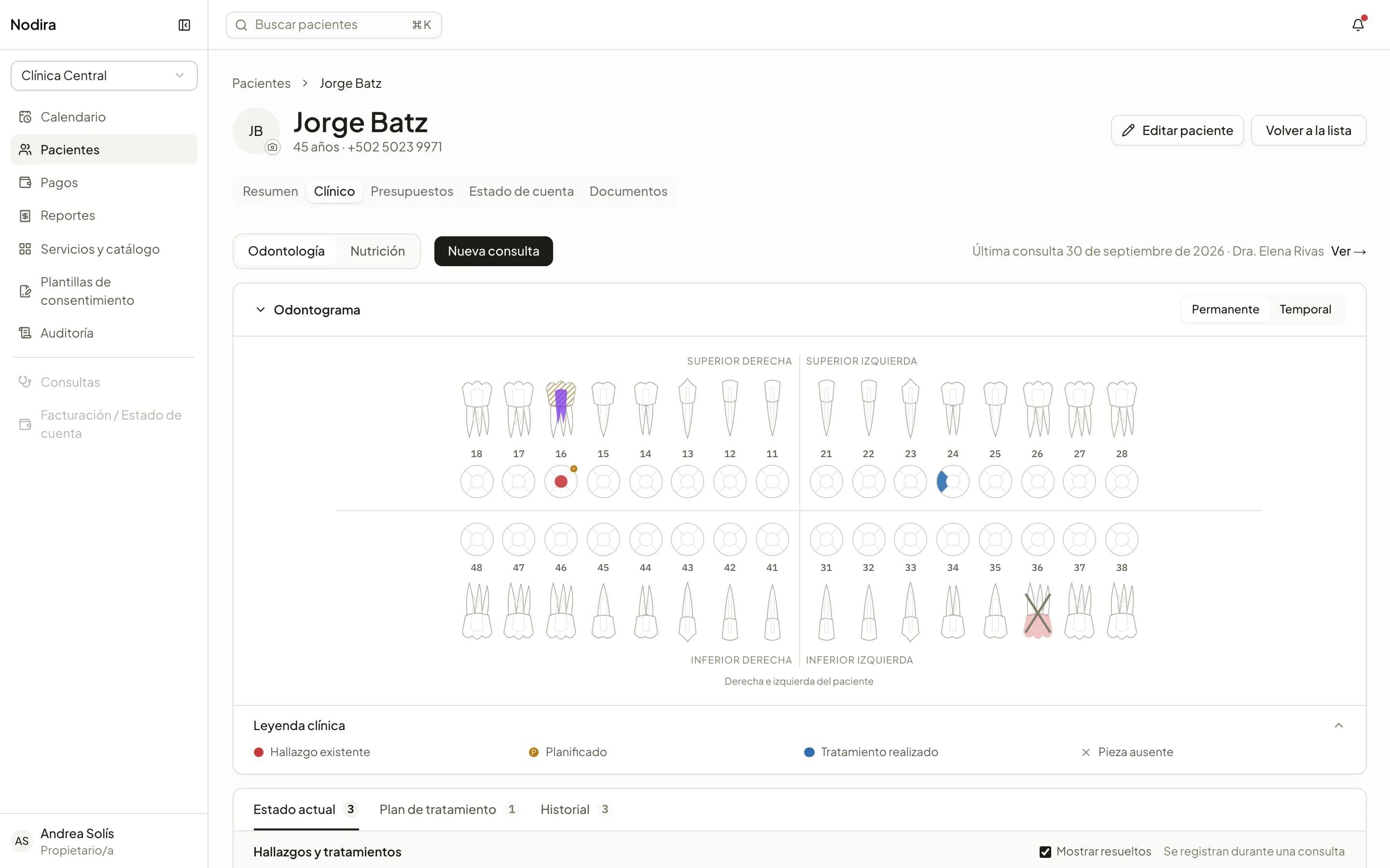 El odontograma de un paciente con hallazgos, tratamientos realizados y planificados.